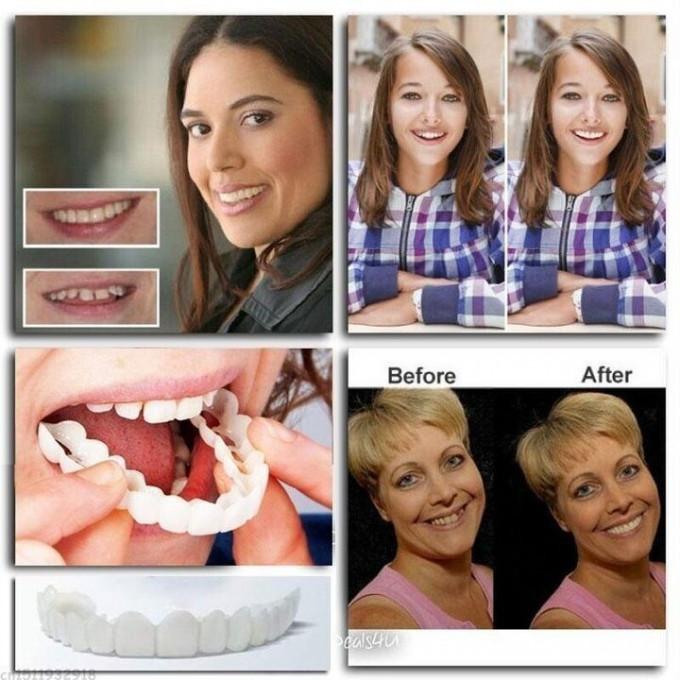 (משלוח חינם)👨⚕תותבות מתכווננות💝הנחה ביום אחרון-(💥79% הנחה) 🔥 מבצע חם🔥🎉